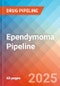 Ependymoma - Pipeline Insight, 2025 - Product Thumbnail Image